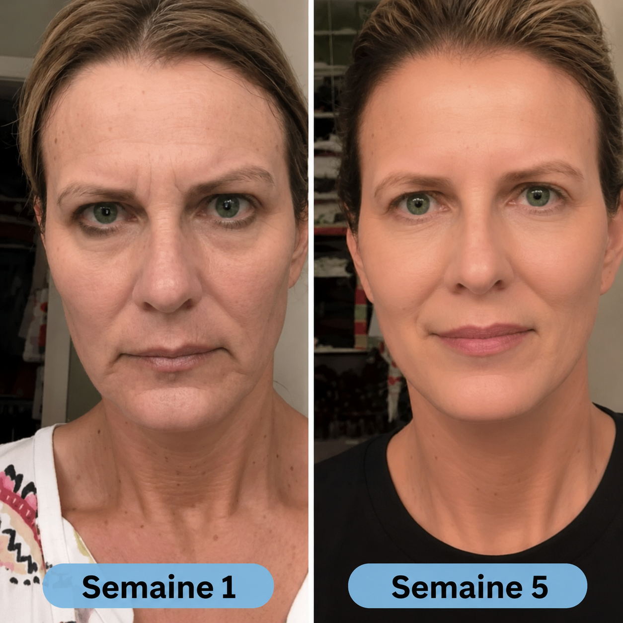 VoluFine | Sérum coréen au collagène pour peaux matures