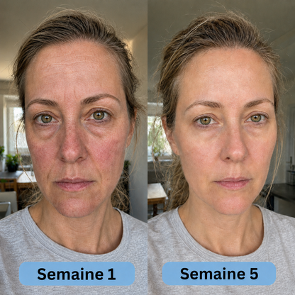 VoluFine | Sérum coréen au collagène pour peaux matures